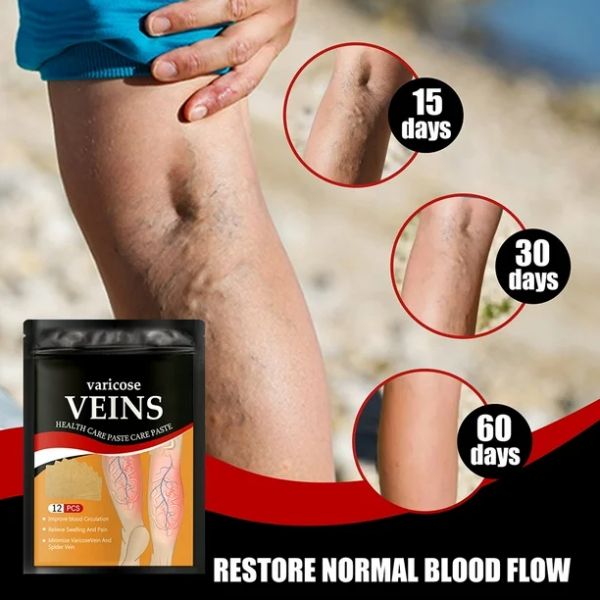 Varicose™ Parches Herbales Para Piernas Cansadas (2x1)
