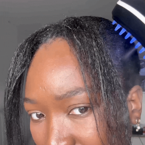 UltraHair™ Terapia Para el Crecimiento de tu Cabello